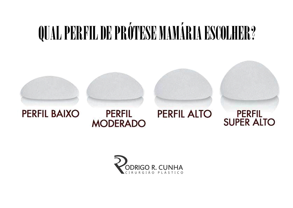 MODELOS DE SILICONE - Rodrigo Rocha